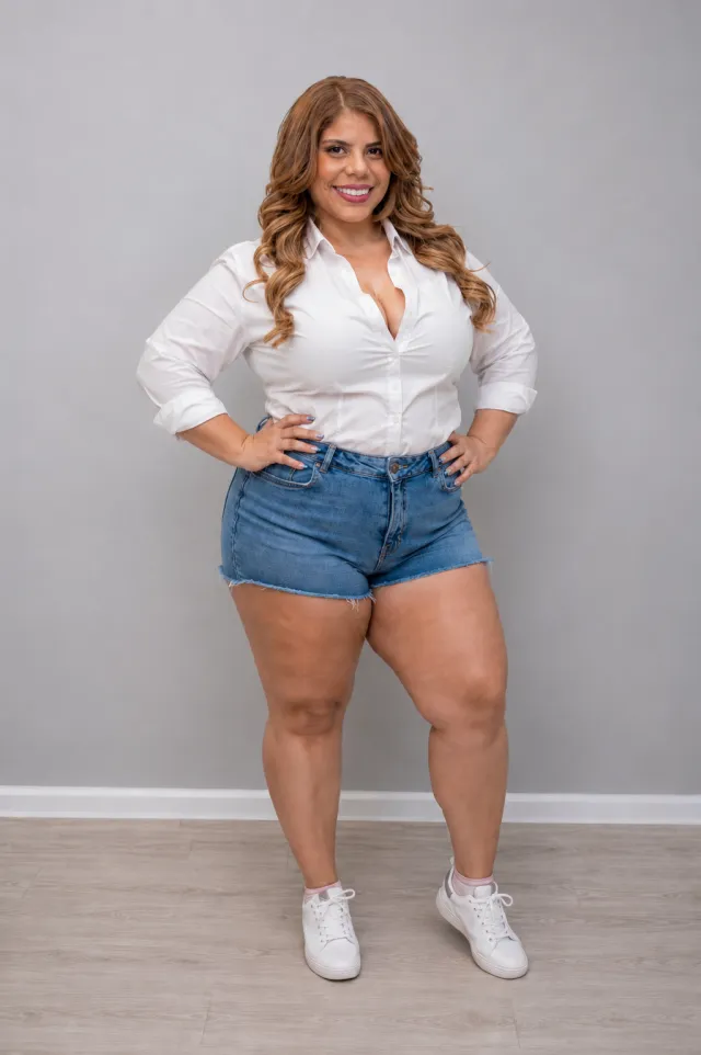 Illustrative visualization of before and estimated after bariatric surgery — Before